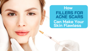 How Fillers for Acne Scars Can Make Your Skin Flawless - Remedium Korea